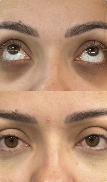 olhos2.webp